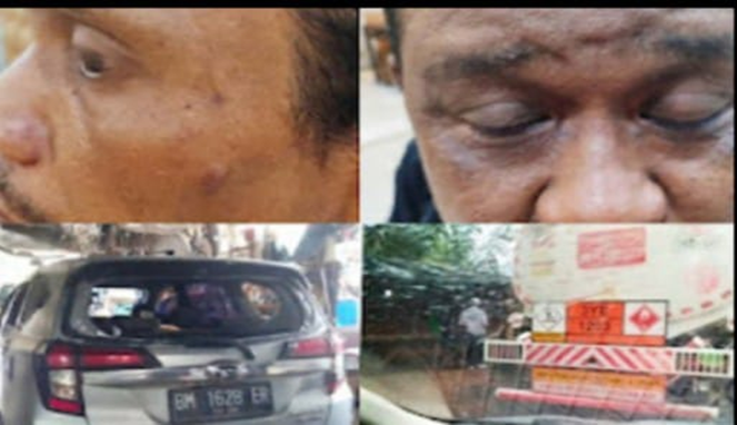 Brutal! Mafia BBM Subsidi Siksa Wartawan, Rampas Harta, dan Ancam Bakar dengan Bensin