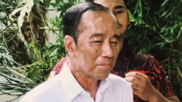 Jokowi Mundur dari PSI, Pertanda Kondisi Kesehatan Menurun?