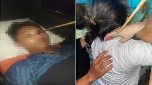 Busur Panah Menggila di Tallo, Pemuda Kena Mata, Perempuan Kena Leher